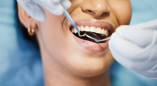 Best Teeth Whitening  in Proctor, VT