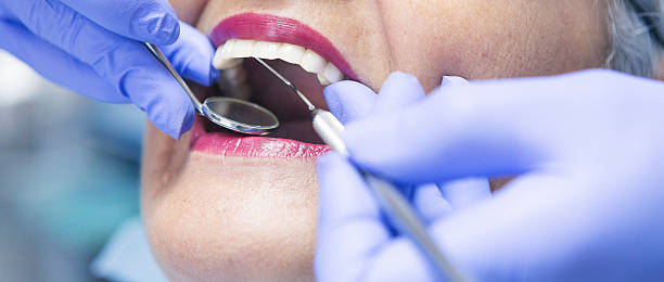 Best Dentist for Tooth Abscess  in Proctor, VT